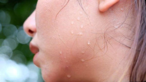 Cách làm sạch da mặt cho người hay đổ mồ hôi.