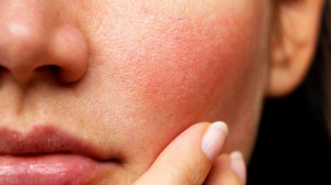 Vì sao rửa mặt quá lâu lại khiến da dễ kích ứng?