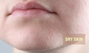 Rửa mặt xong nên làm gì để da không bị khô?
