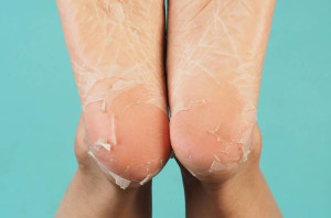 Cách peel da body tại nhà an toàn và hiệu quả.