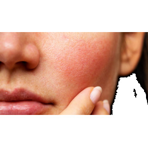 Vì sao rửa mặt quá lâu lại khiến da dễ kích ứng?