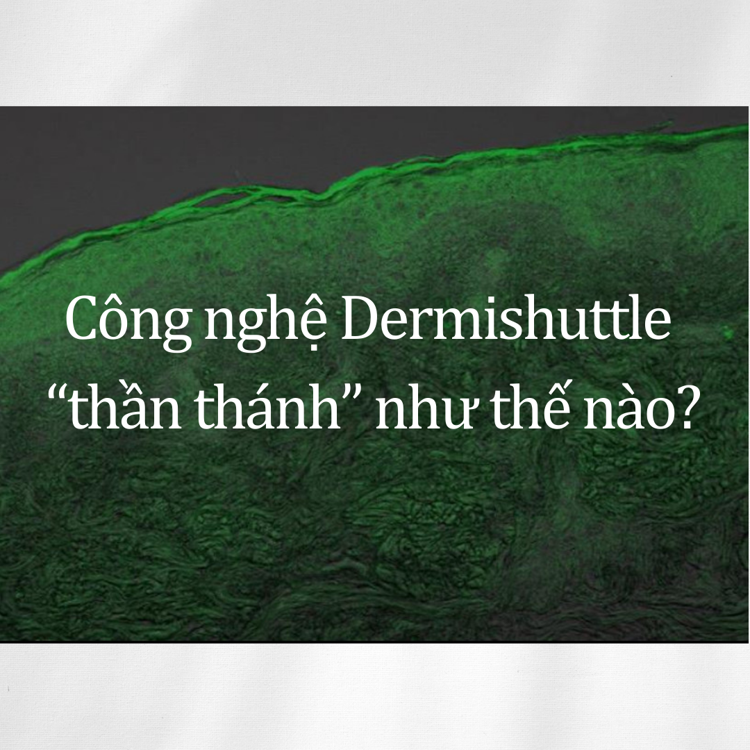 Công nghệ DermiShuttle là gì mà lại 